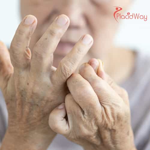 Терапия стволовыми клетками ревматоидного артрита в Индии